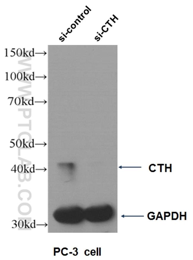 Gamma cystathionase Antibody in Western Blot (WB)