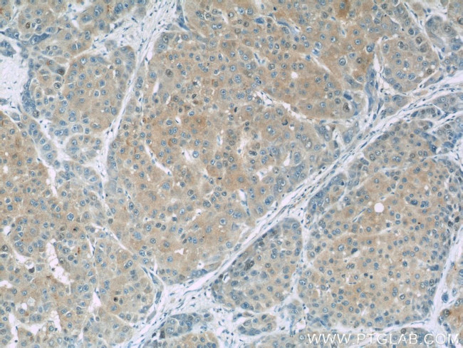 Gamma cystathionase Antibody in Immunohistochemistry (Paraffin) (IHC (P))