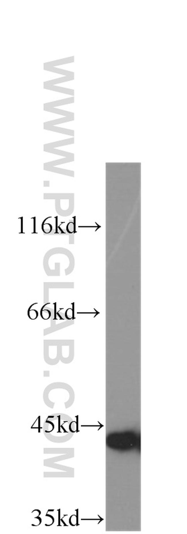 Gamma cystathionase Antibody in Western Blot (WB)