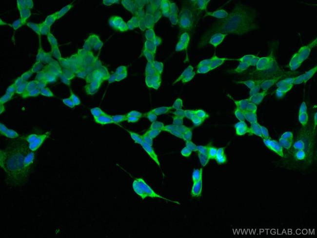 NCAM1/CD56 Antibody in Immunocytochemistry (ICC/IF)