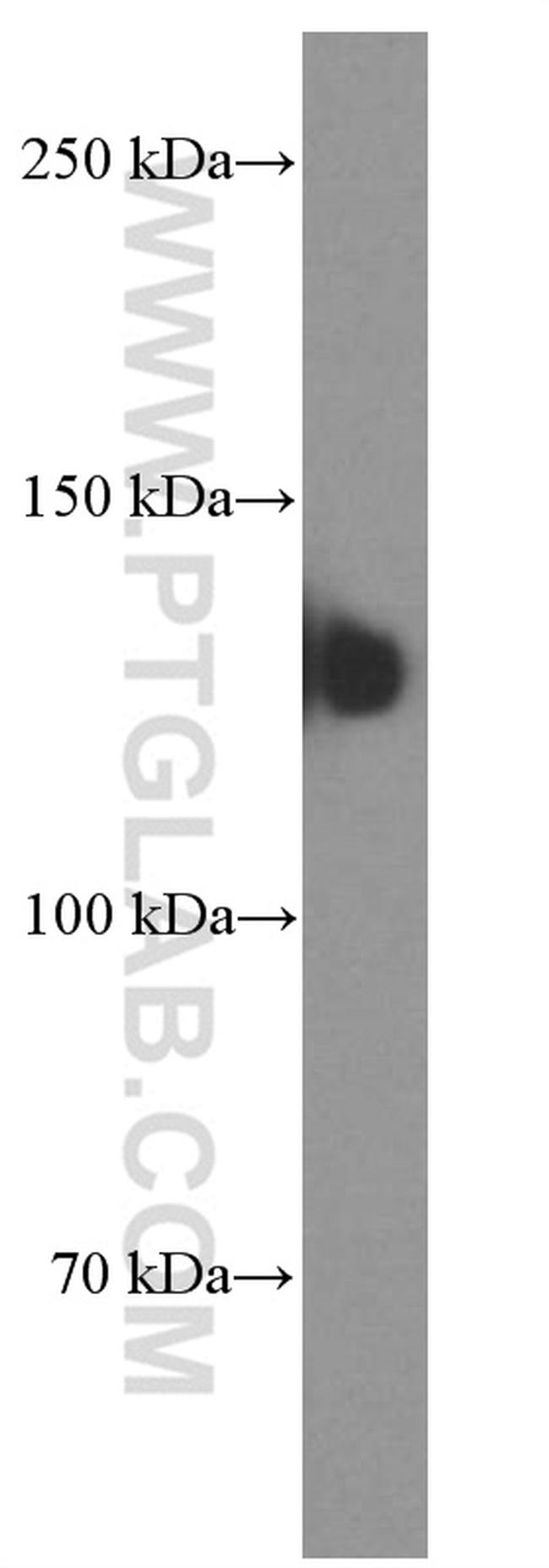 NCAM1/CD56 Antibody in Western Blot (WB)