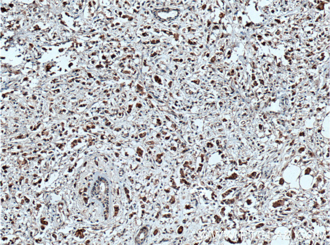 OCT4 Antibody in Immunohistochemistry (Paraffin) (IHC (P))