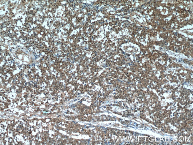 OCT4 Antibody in Immunohistochemistry (Paraffin) (IHC (P))