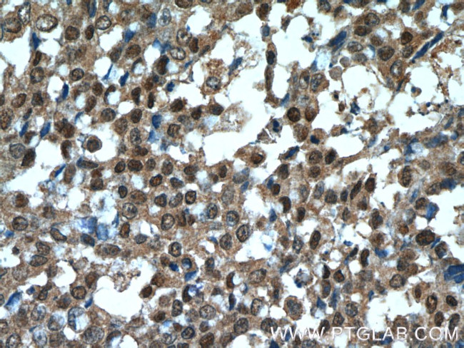 OCT4 Antibody in Immunohistochemistry (Paraffin) (IHC (P))