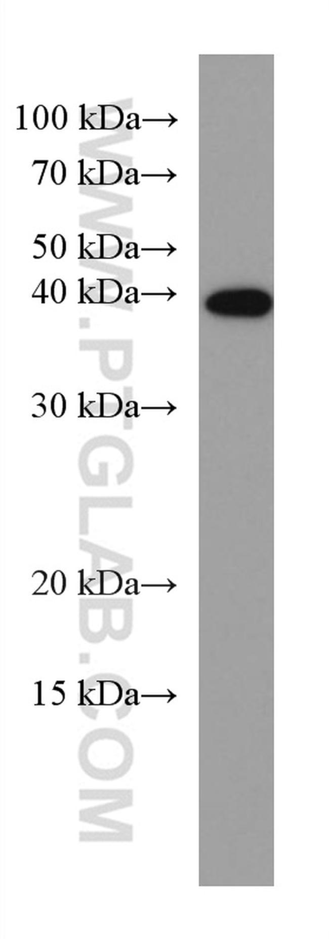 CDX2 Antibody in Western Blot (WB)