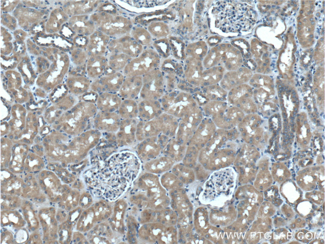 PLAA Antibody in Immunohistochemistry (Paraffin) (IHC (P))