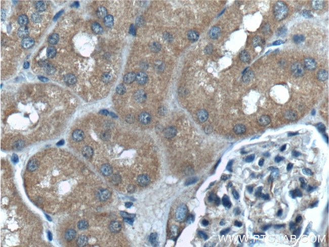 PLAA Antibody in Immunohistochemistry (Paraffin) (IHC (P))