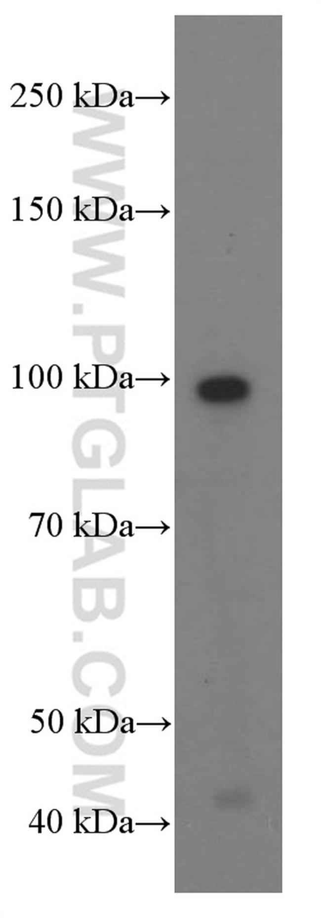 PLAA Antibody in Western Blot (WB)