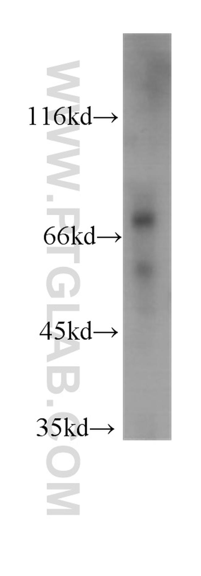 PLAA Antibody in Western Blot (WB)