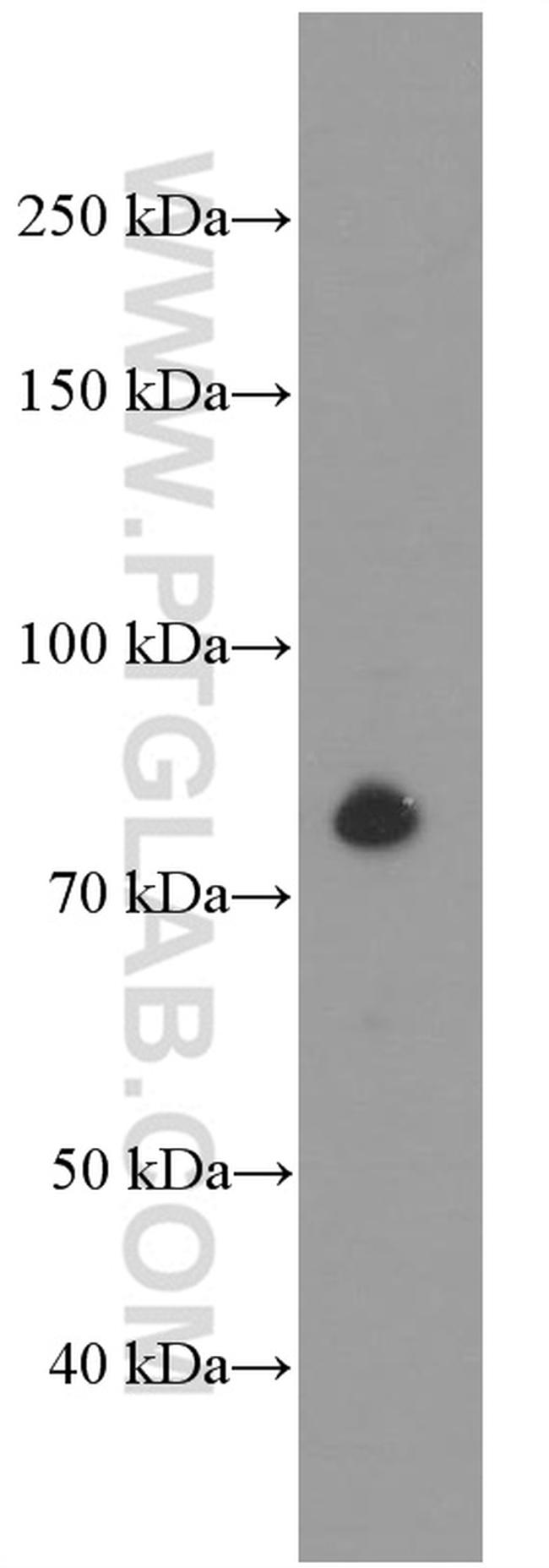 PLAA Antibody in Western Blot (WB)