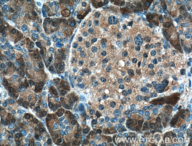 4EBP1 Antibody in Immunohistochemistry (Paraffin) (IHC (P))