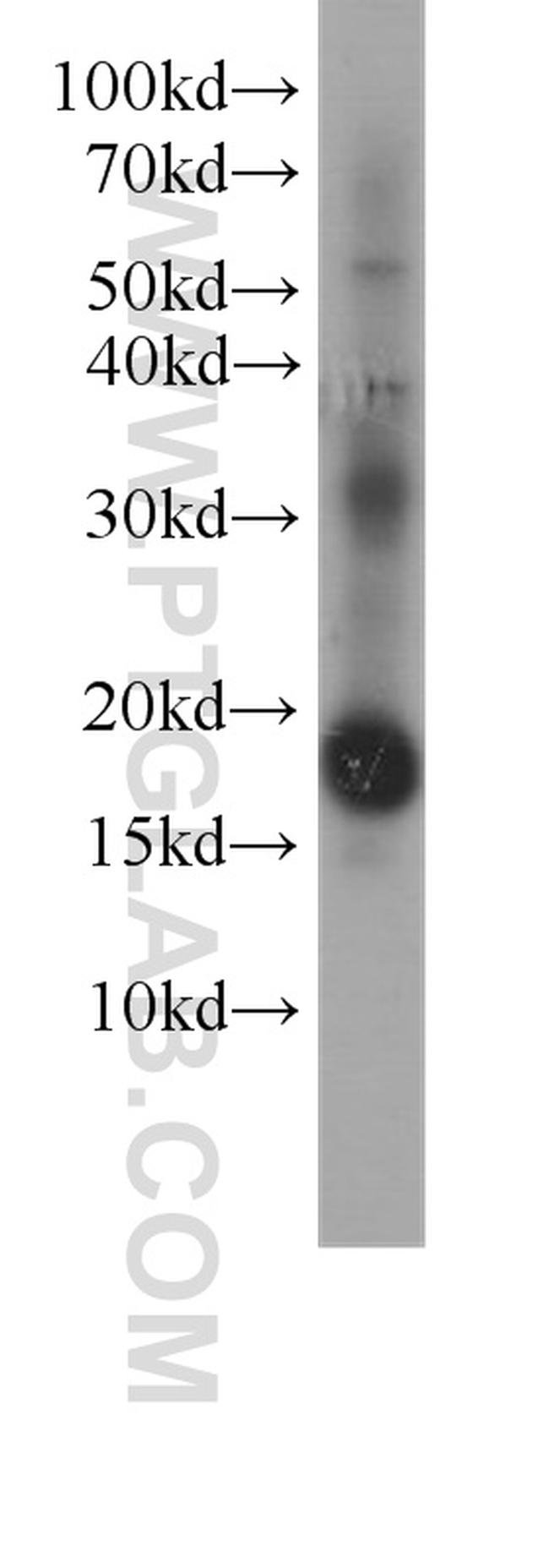 4EBP1 Antibody in Western Blot (WB)