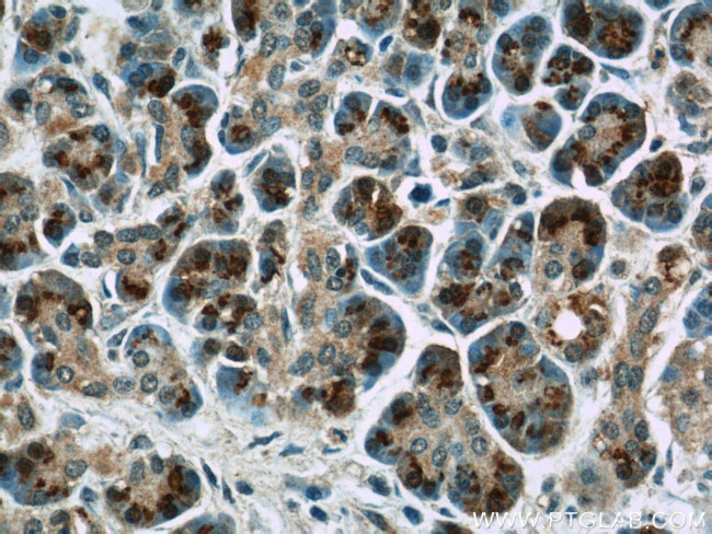 4EBP1 Antibody in Immunohistochemistry (Paraffin) (IHC (P))