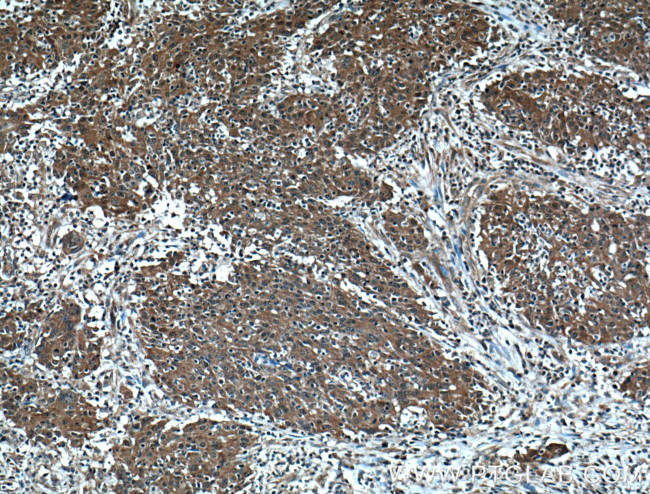 4EBP1 Antibody in Immunohistochemistry (Paraffin) (IHC (P))