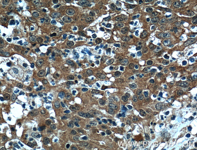 4EBP1 Antibody in Immunohistochemistry (Paraffin) (IHC (P))