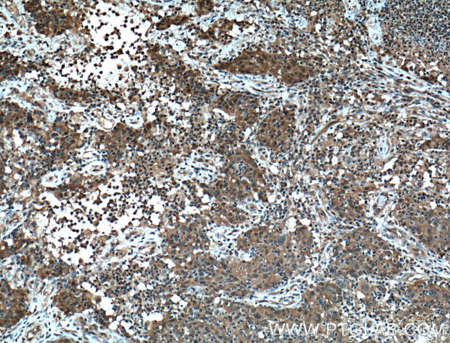 4EBP1 Antibody in Immunohistochemistry (Paraffin) (IHC (P))