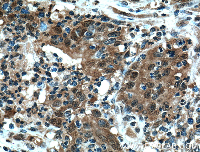 4EBP1 Antibody in Immunohistochemistry (Paraffin) (IHC (P))