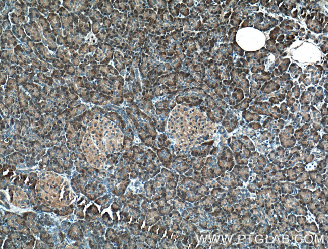 4EBP1 Antibody in Immunohistochemistry (Paraffin) (IHC (P))