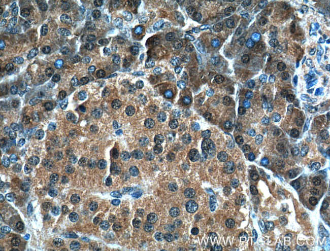 4EBP1 Antibody in Immunohistochemistry (Paraffin) (IHC (P))