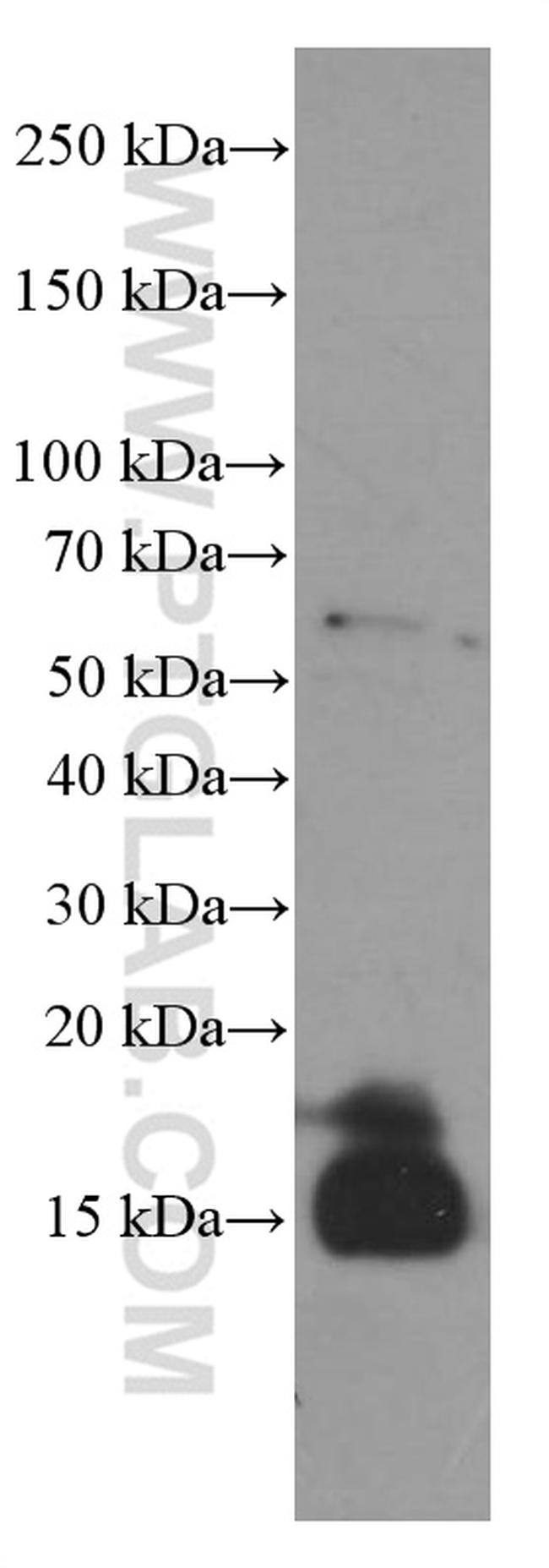 4EBP1 Antibody in Western Blot (WB)