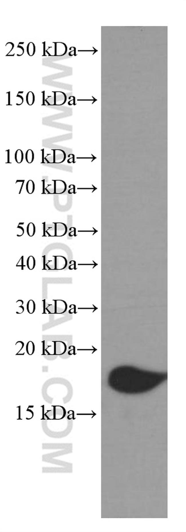 4EBP1 Antibody in Western Blot (WB)