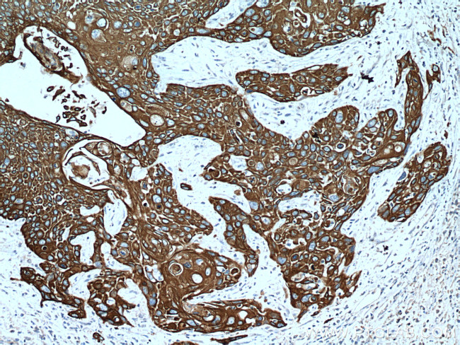 Cytokeratin 15 Antibody in Immunohistochemistry (Paraffin) (IHC (P))