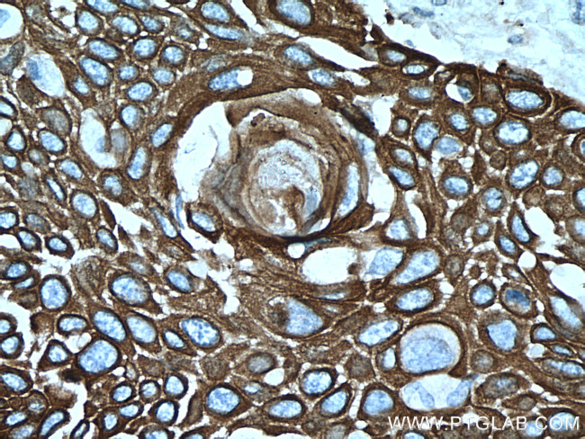 Cytokeratin 15 Antibody in Immunohistochemistry (Paraffin) (IHC (P))