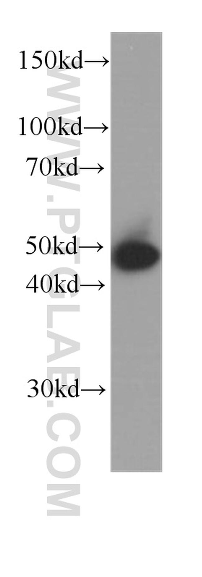 Cytokeratin 15 Antibody in Western Blot (WB)