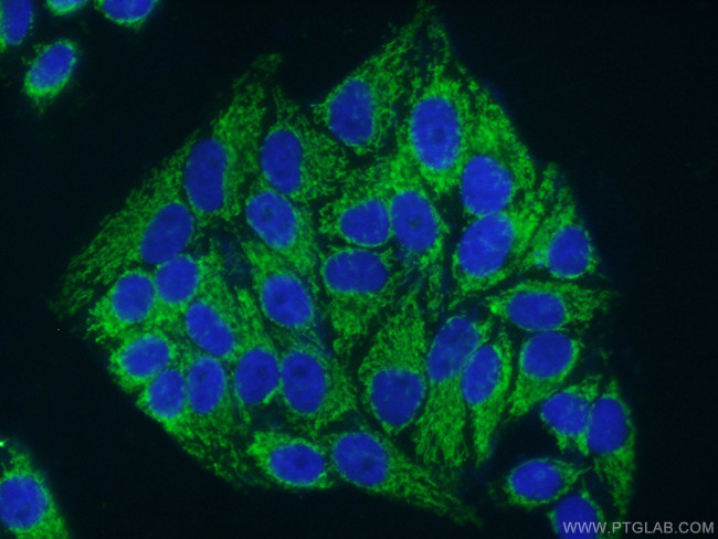 HADHA Antibody in Immunocytochemistry (ICC/IF)