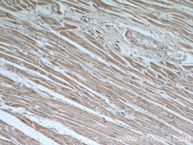 HADHA Antibody in Immunohistochemistry (Paraffin) (IHC (P))