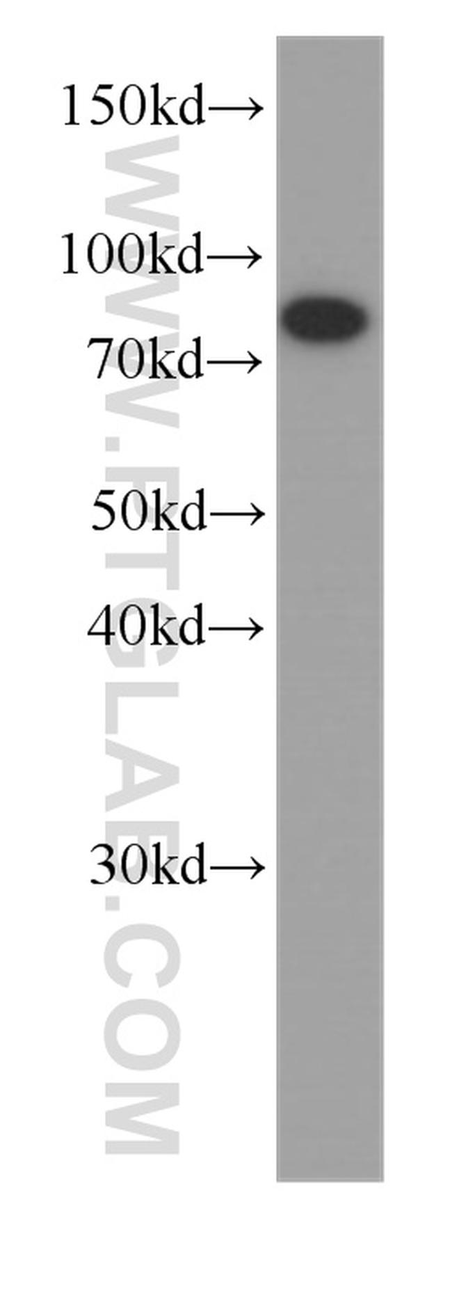 HADHA Antibody in Western Blot (WB)