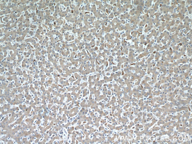 HADHA Antibody in Immunohistochemistry (Paraffin) (IHC (P))