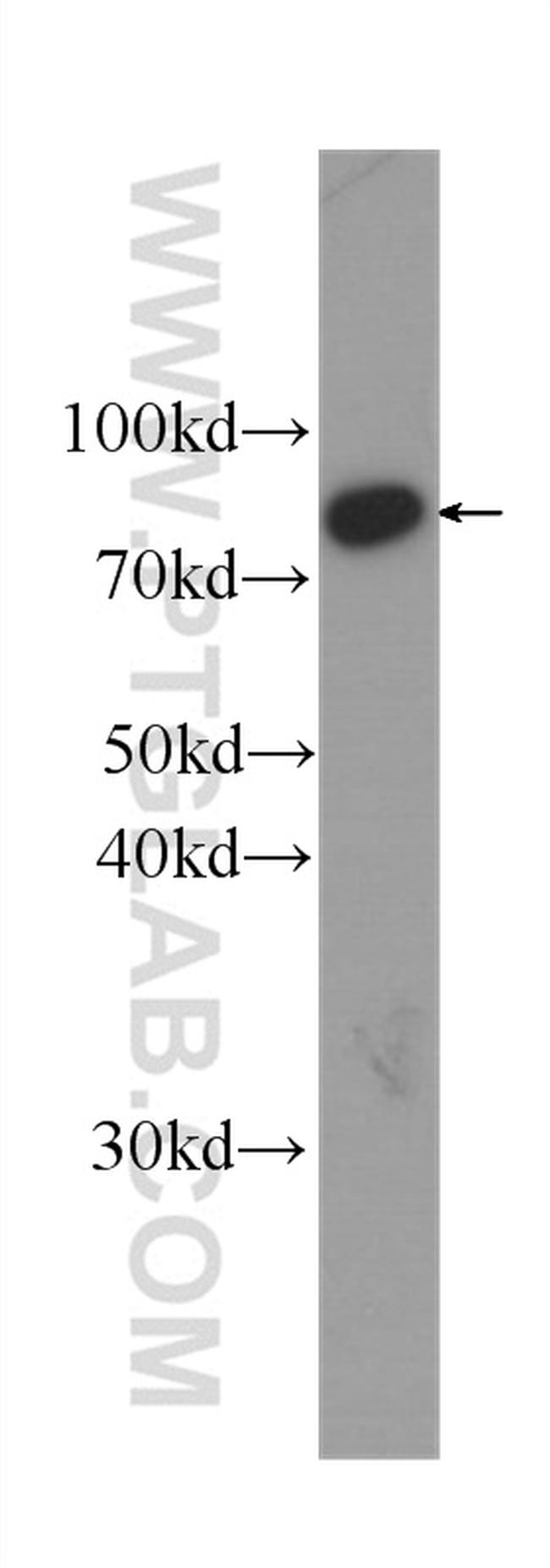 HADHA Antibody in Western Blot (WB)