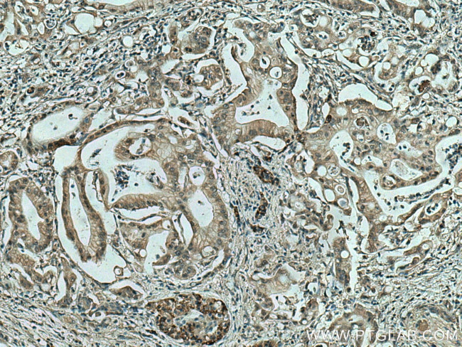 MAPK13 Antibody in Immunohistochemistry (Paraffin) (IHC (P))