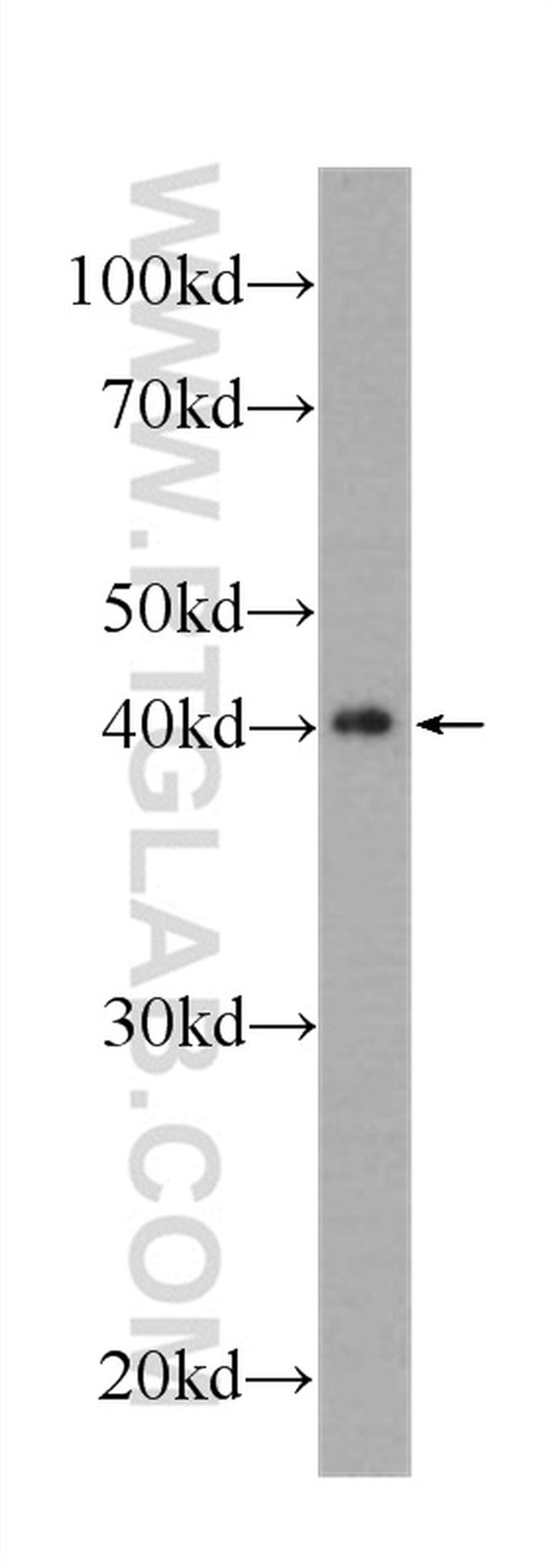 MAPK13 Antibody in Western Blot (WB)