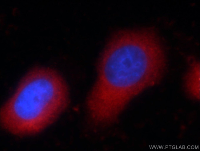 Zyxin Antibody in Immunocytochemistry (ICC/IF)