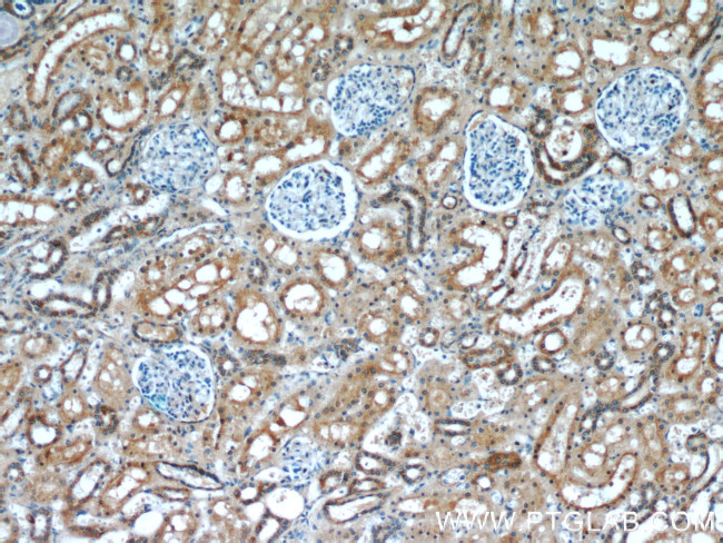 Zyxin Antibody in Immunohistochemistry (Paraffin) (IHC (P))