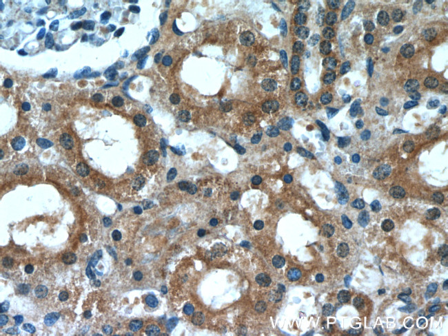 Zyxin Antibody in Immunohistochemistry (Paraffin) (IHC (P))