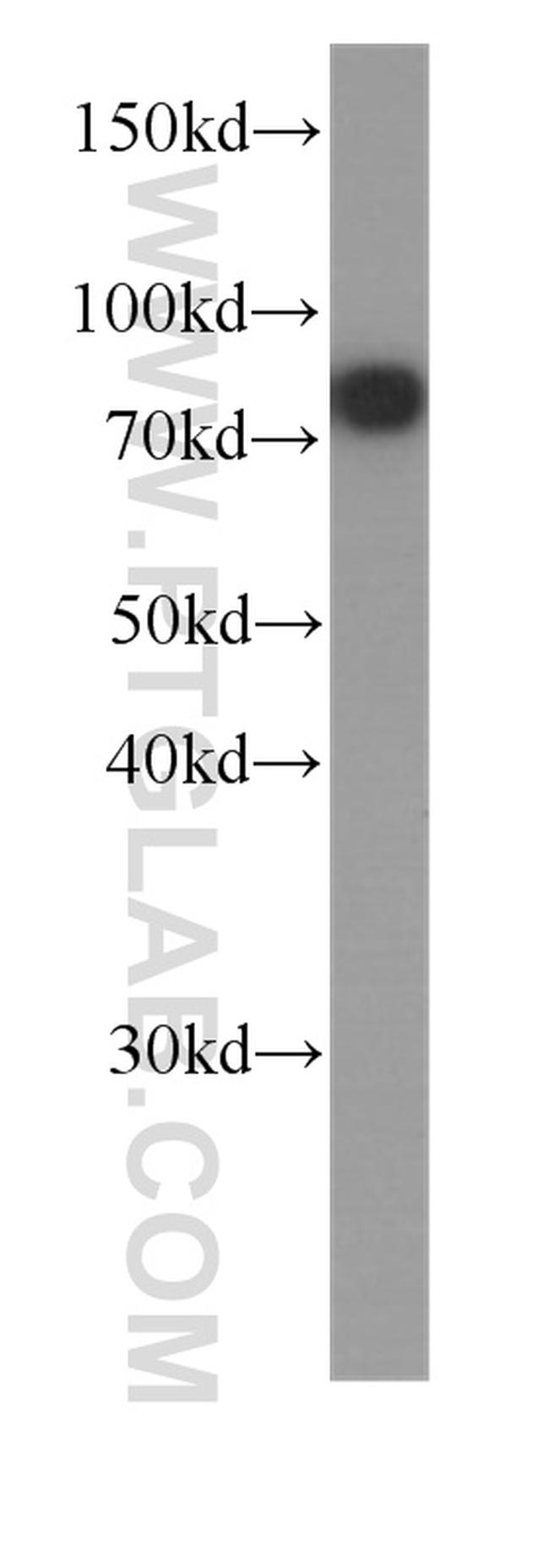 Zyxin Antibody in Western Blot (WB)