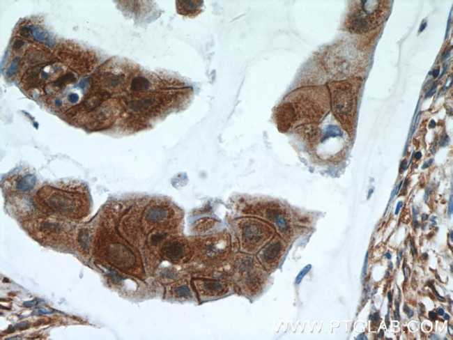 Zyxin Antibody in Immunohistochemistry (Paraffin) (IHC (P))