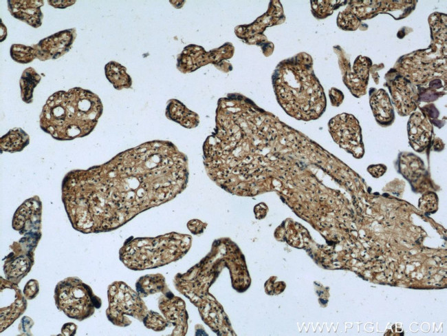 Zyxin Antibody in Immunohistochemistry (Paraffin) (IHC (P))