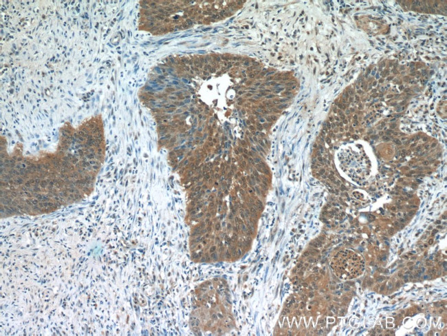 Zyxin Antibody in Immunohistochemistry (Paraffin) (IHC (P))