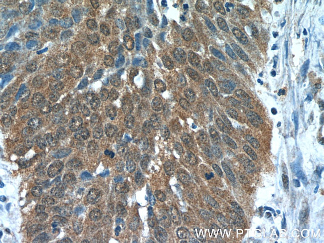 Zyxin Antibody in Immunohistochemistry (Paraffin) (IHC (P))