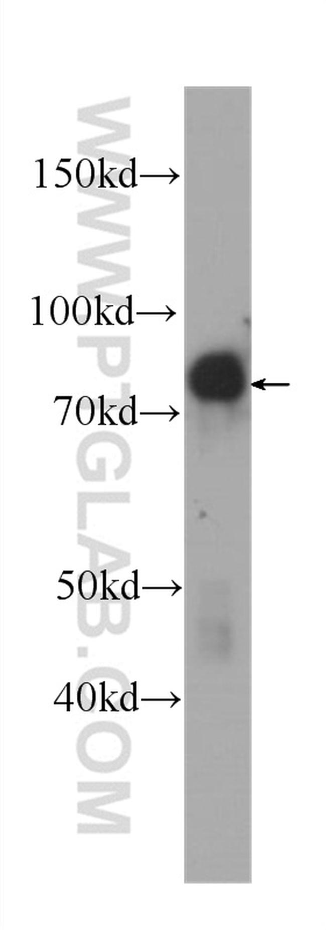 Zyxin Antibody in Western Blot (WB)