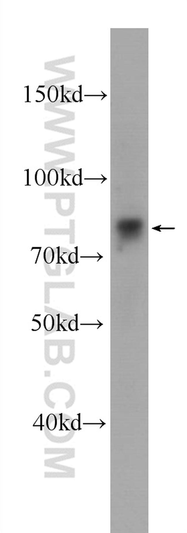 Zyxin Antibody in Western Blot (WB)