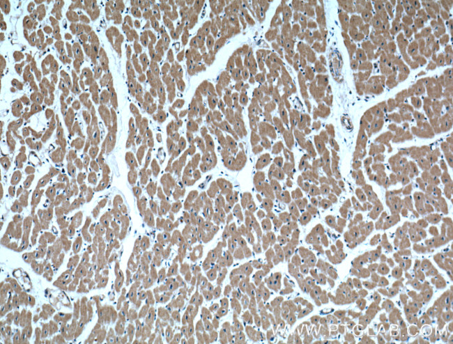 IGBP1 Antibody in Immunohistochemistry (Paraffin) (IHC (P))