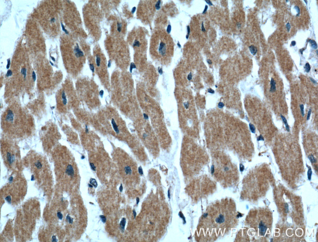 IGBP1 Antibody in Immunohistochemistry (Paraffin) (IHC (P))