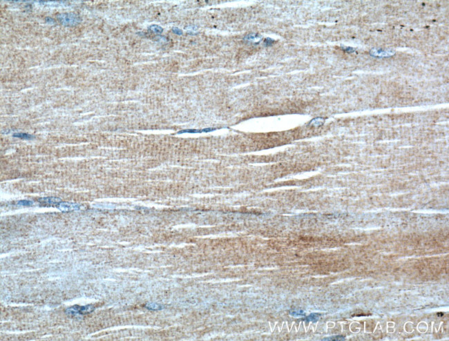 IGBP1 Antibody in Immunohistochemistry (Paraffin) (IHC (P))