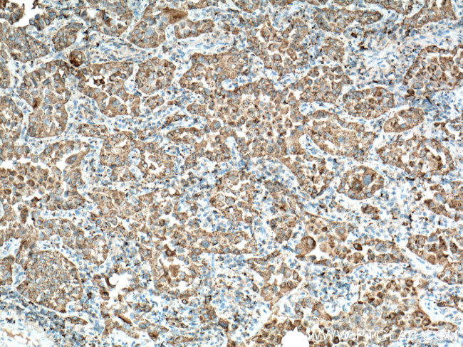 NAPSA Antibody in Immunohistochemistry (Paraffin) (IHC (P))