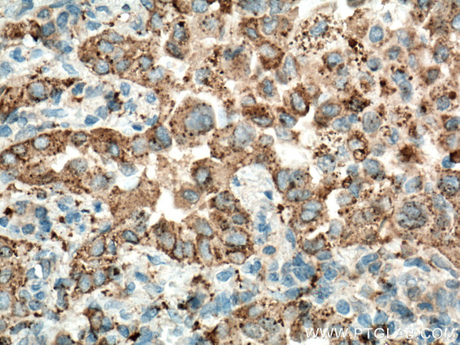 NAPSA Antibody in Immunohistochemistry (Paraffin) (IHC (P))